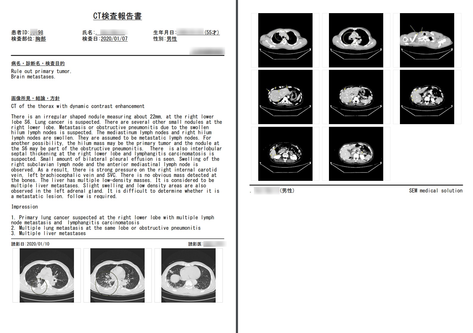遠隔画像診断のpdfレポート画面英語表記